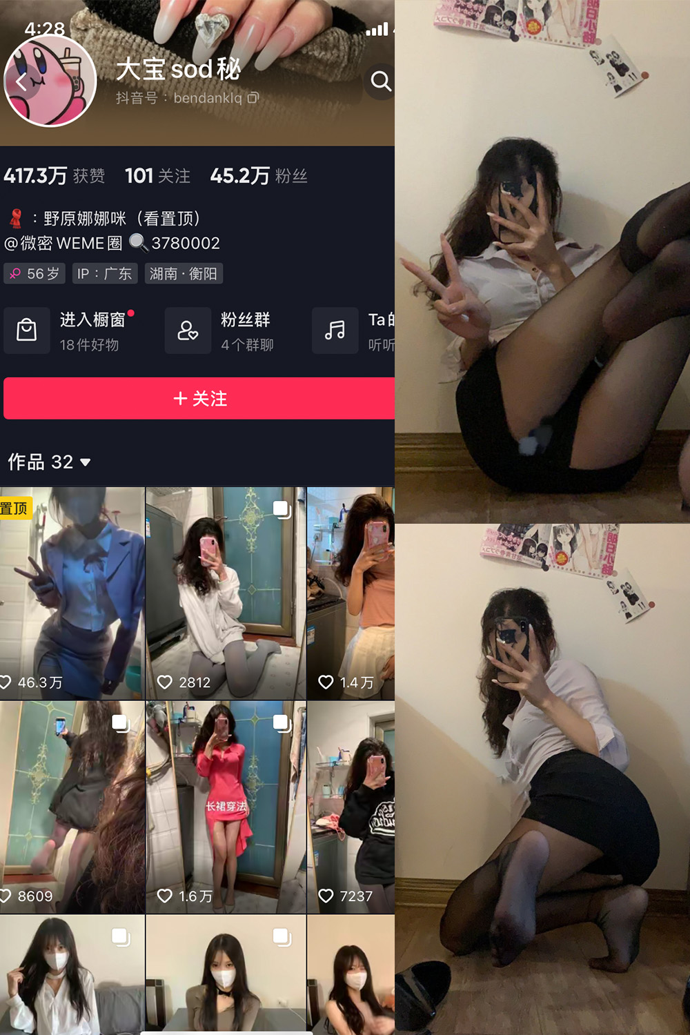 抖音 大宝sod秘 微密圈  NO.006期 【14P】最新(抖音大宝怎么了)插图