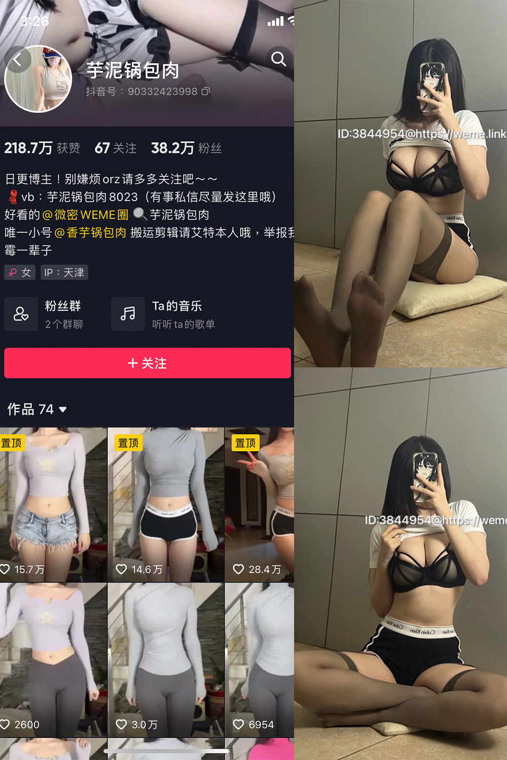 抖音 芋泥锅包肉 微密圈  NO.004期 【14P】(抖音芋泥锅包肉的以前视频)插图