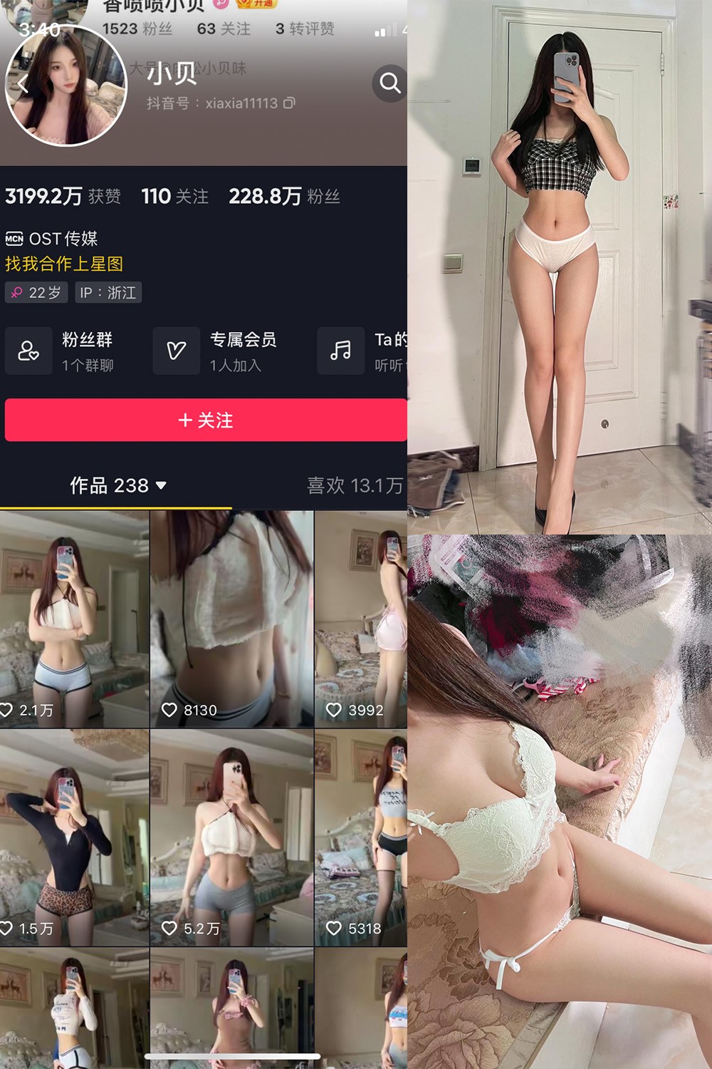 抖音 小贝 VIP 微密圈 NO.012期 【25P4V】(小贝会员)插图